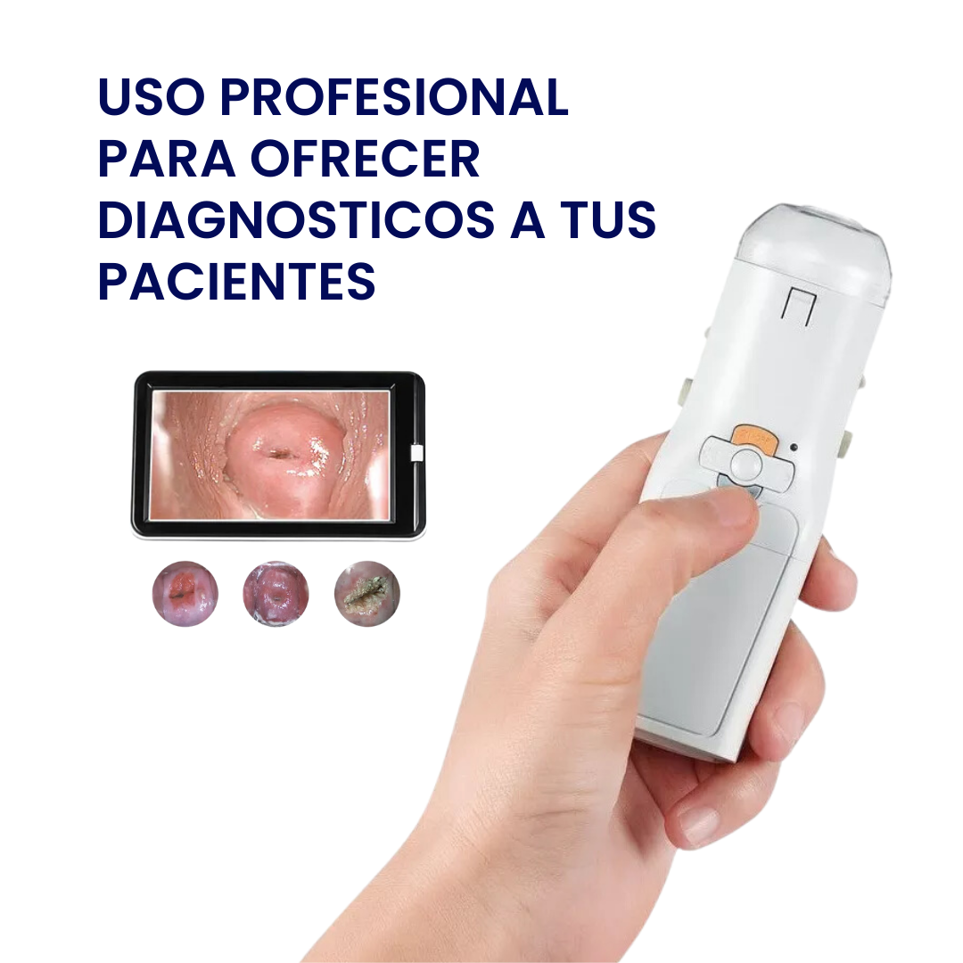 Colposcopio Portatil