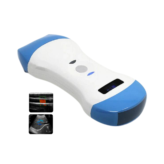 Ultrasonido Wireless Color Doppler Transductor Convexo y Lineal